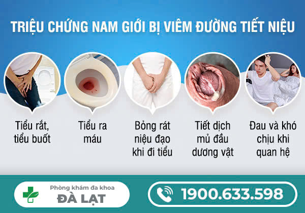 Hình ảnh minh họa